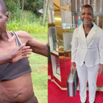 Amazing Transformation Of Conjestina Achieng After Months In Rehabilitation